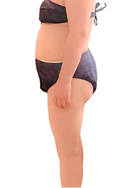 腹部施術後